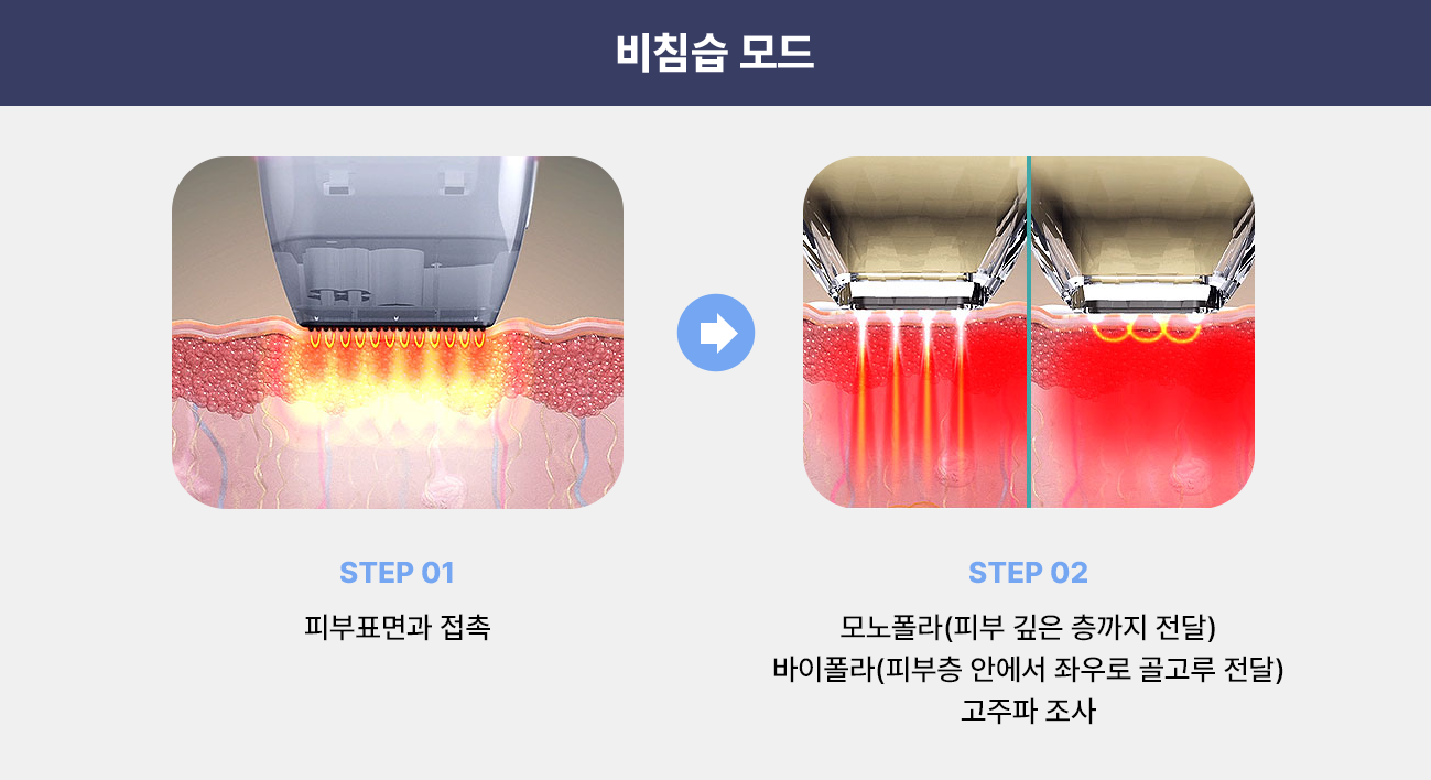 1개 라인만 조사하는 다른 하이푸 장비와 달리 2개 라인으로 된 어플리케이터로 조사 하기 때문에 얇거나 국소 부분까지 피부표면 손상없이 탄력 개선에 도움을 받을 수 있습니다.